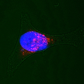 Syntaxin 7 antibody in HeLa Human Cell Line by Immunocytochemistry (ICC).