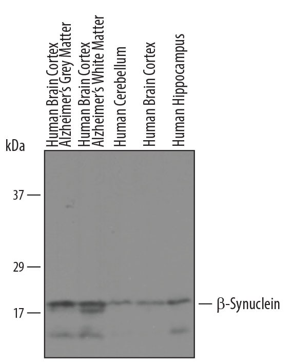 Detection of Human  beta -Synuclein antibody by Western Blot.