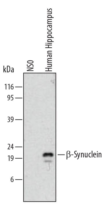 Detection of Human  beta -Synuclein antibody by Western Blot.