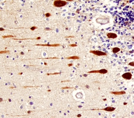 ?-Synuclein antibody in Human Cerebellum by Immunohistochemistry (IHC-P).
