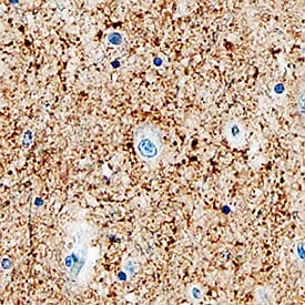 a-Synuclein antibody in Human Brain by Immunohistochemistry (IHC-P).