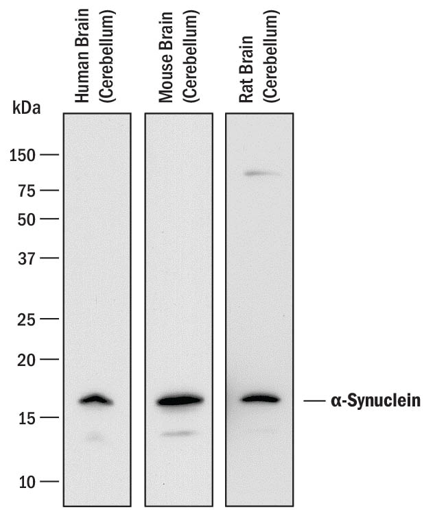 Detection of Human, Mouse, and Rat a-Synuclein antibody by Western Blot.