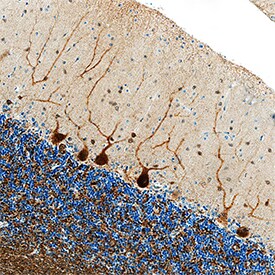 ?-Synuclein antibody in Human Brain by Immunohistochemistry (IHC-P).
