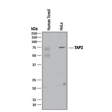 Detection of Human TAP2 antibody by Western Blot.