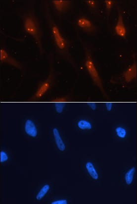 TCF-3/E2A antibody in HeLa Human Cell Line by Immunocytochemistry (ICC).