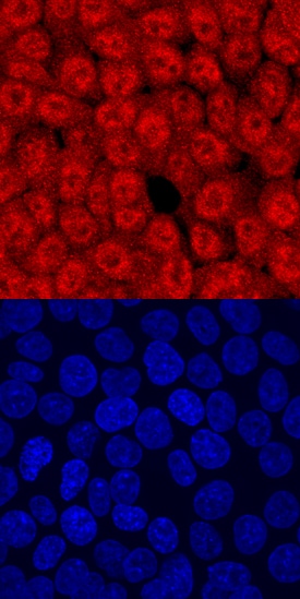 TCF7/TCF1 antibody in HCT-116 Human Cell Line by Immunocytochemistry (ICC).