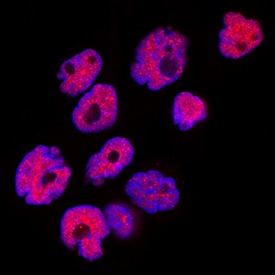 TDP-43/TARDBP antibody in Mouse Splenocytes by Immunocytochemistry (ICC).
