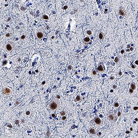 TDP-43/TARDBP antibody in Human Brain by Immunohistochemistry (IHC-P).