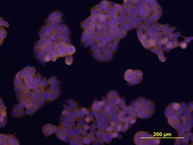 TEM8 antibody in HT-29 Human Cell Line by Immunocytochemistry (ICC).