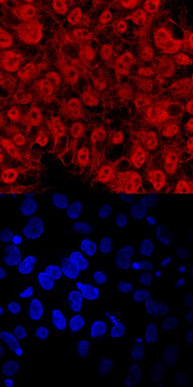 TEX19 antibody in BG01V Human Stem Cells by Immunocytochemistry (ICC).