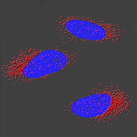 TFEB antibody in A549 Human Cell Line by Immunocytochemistry (ICC).