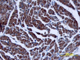 TGF-beta 3 antibody in Human Heart by Immunohistochemistry (IHC-P).