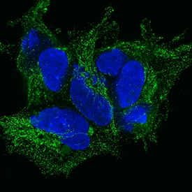 TGF-beta 1 antibody in HEK293 Human Cell Line by Immunocytochemistry (ICC).