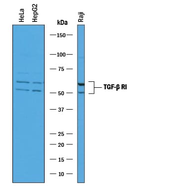 Detection of Human TGF‑ beta  RI/ALK‑5 antibody by Western Blot.
