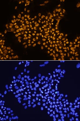 THAP11 antibody in BG01V Human Stem Cells by Immunocytochemistry (ICC).
