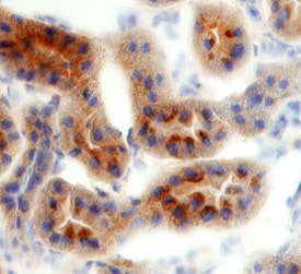 TIM-1/KIM-1/HAVCR antibody in Rat Kidney by Immunohistochemistry (IHC-Fr).