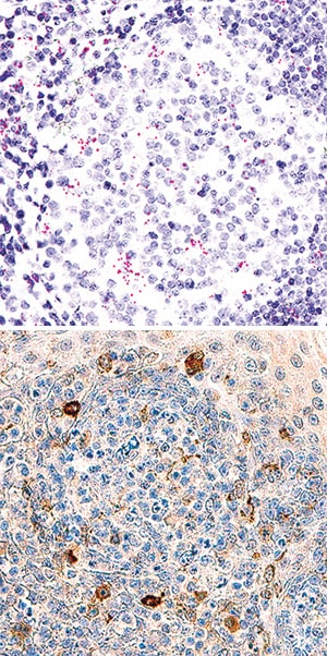 TIM-3 antibody in Human Tonsil Using Dual RNAscope®ISH and IHC.