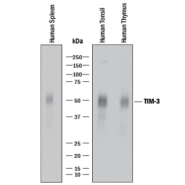 Detection of Human TIM-3 antibody by Western Blot.