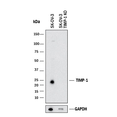 Western Blot Shows Human TIMP-1 Antibody Specificity by Using Knockout Cell Line.