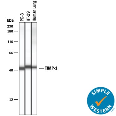 Detection of Human TIMP-1 antibody by Simple WesternTM.