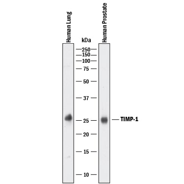 Detection of Human TIMP-1 antibody by Western Blot.