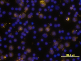 TLR4 antibody in Human PBMCs by Immunocytochemistry (ICC).