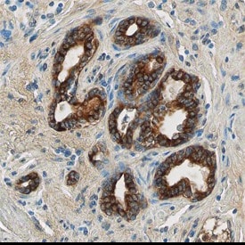 TLR4 antibody in Human Prostate by Immunohistochemistry (IHC-P).