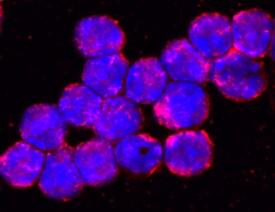 TLR9 antibody in Mouse Splenocytes by Immunocytochemistry (ICC).