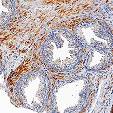 TMEM219 antibody in Human Prostate Gland by Immunohistochemistry (IHC-P).