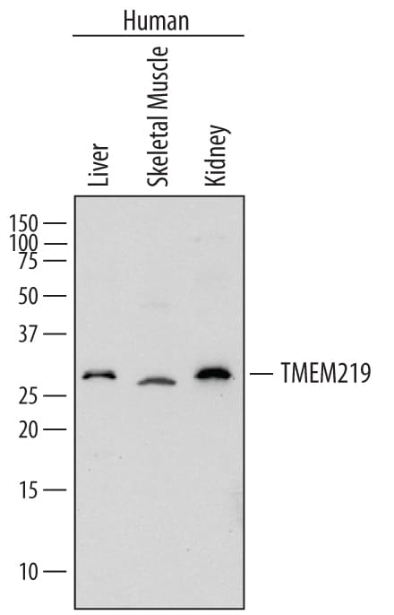 Detection of Human TMEM219 antibody by Western Blot.