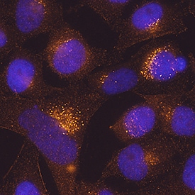 TMEM59 antibody in HeLa Human Cell Line by Immunocytochemistry (ICC).