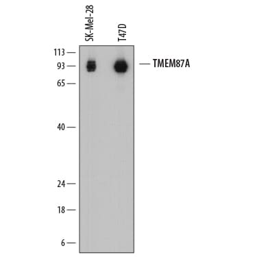 Detection of Human TMEM87A antibody by Western Blot.