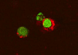 TNF-a antibody in Mouse T Cells by Immunocytochemistry (ICC).