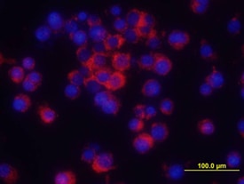 TNF-a antibody in RAW 264 by Immunocytochemistry (ICC).7 Mouse Cell Line by Immunocytochemistry (ICC).