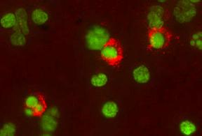 TNF RII/TNFRSF1B antibody in Human Peripheral Blood Lymphocytes by Immunocytochemistry (ICC).