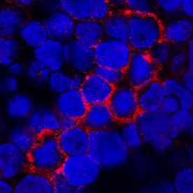 TNF RII/TNFRSF1B antibody in Human PBMCs by Immunocytochemistry (ICC).