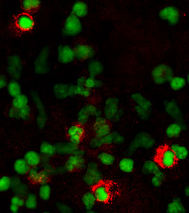 TNF RI/TNFRSF1A antibody in Human Peripheral Blood Lymphocytes by Immunocytochemistry (ICC).