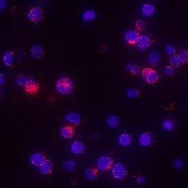TNF-a antibody in Human PBMCs by Immunocytochemistry (ICC).