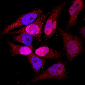 TOP2A antibody in HeLa Human Cell Line by Immunocytochemistry (ICC).