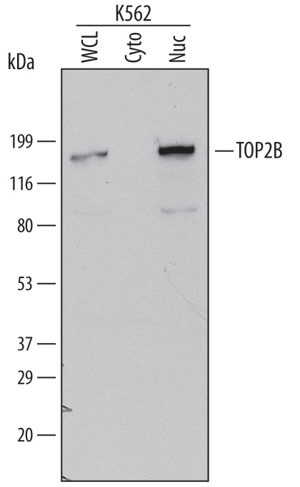 Detection of Human TOP2B antibody by Western Blot.