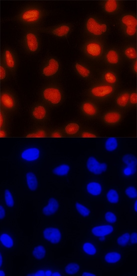 TOP2B antibody in HeLa Human Cell Line by Immunocytochemistry (ICC).