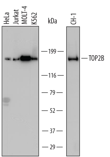 Detection of Human and Mouse TOP2B antibody by Western Blot.