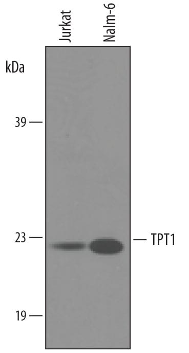 Detection of Human TPT1/TCTP antibody by Western Blot.
