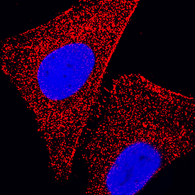 TPT1/TCTP antibody in HeLa Human Cell Line by Immunocytochemistry (ICC).