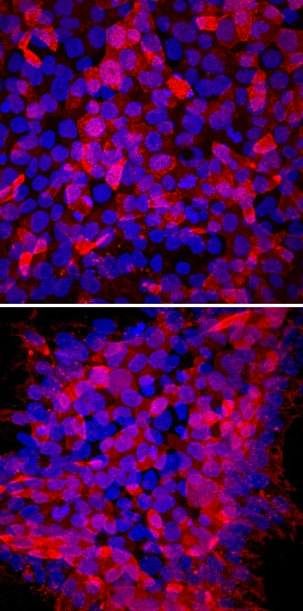 TRA-1-60(R) antibody in ADLF1 and FAB2 Stem Cell Lines by Immunocytochemistry (ICC).