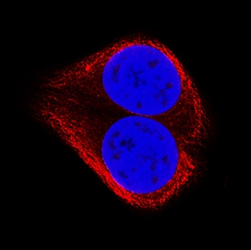 TRADD antibody in MCF-7 Human Cell Line by Immunocytochemistry (ICC).