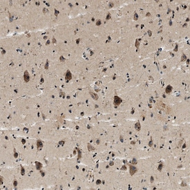 TRAIL R1/TNFRSF10A antibody in Human Brain by Immunohistochemistry (IHC-P).