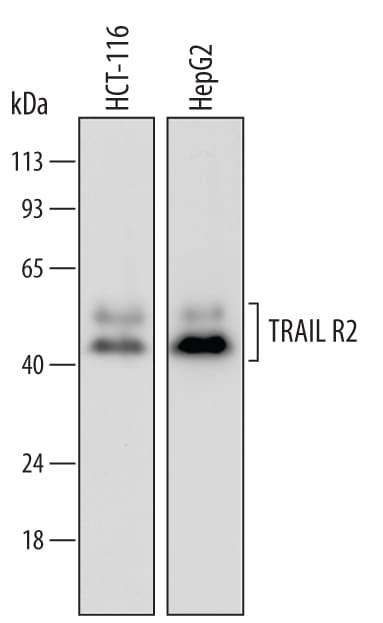 Detection of Human TRAIL R2/TNFRSF10B antibody by Western Blot.