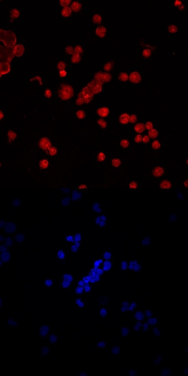 TRAM/TICAM2 antibody in Raji Human Cell Line by Immunocytochemistry (ICC).