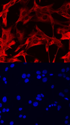 TRAM/TICAM2 antibody in C2C12 Mouse Cell Line by Immunocytochemistry (ICC).